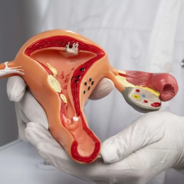 Cystic metabolism treatment